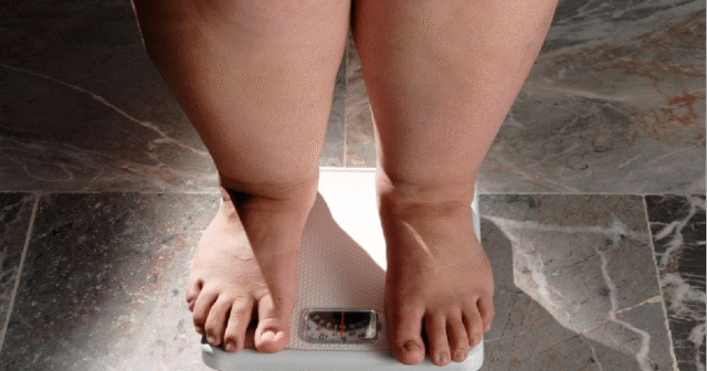 É possível adotar hábitos de prevenção para evitar a obesidade.